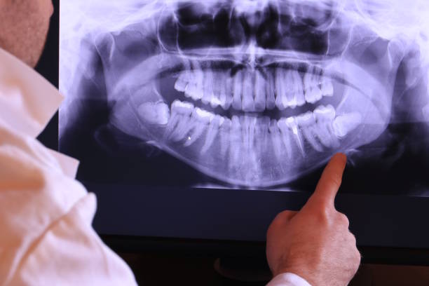 Best Emergency Treatment for Oral Infections in Tuckerman, AR